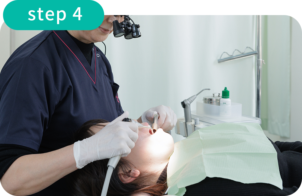 久門田歯科医院のセレック治療-STEP4